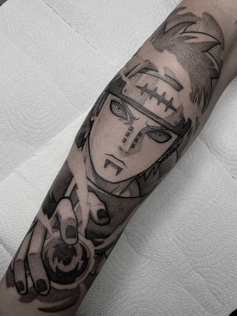 Pain em whipshading no antebraço